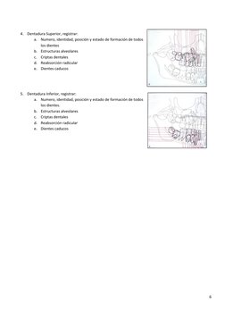 6 
 
 
 
 
4. Dentadura Superior, registrar: 
a. Numero, identidad, posición y estado de formación de todos 
los dientes 
b.