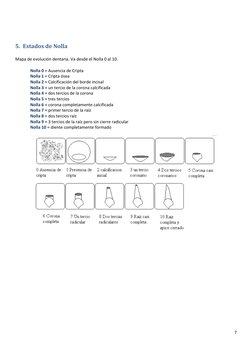 7 
 
 
 
5. Estados de Nolla 
 
Mapa de evolución dentaria. Va desde el Nolla 0 al 10. 
 
Nolla 0 = Ausencia de Cripta 
Nolla