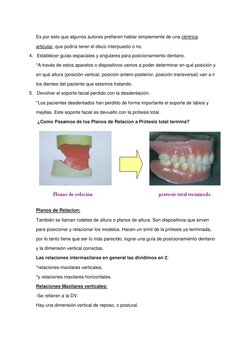 Es por esto que algunos autores prefieren hablar simplemente de una céntrica 
articular, que podría tener el disco interpuest