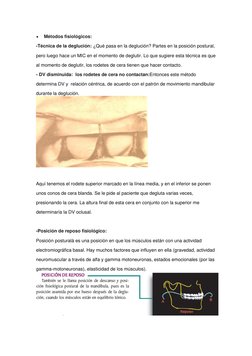  
Métodos fisiológicos: 
-Técnica de la deglución: ¿Qué pasa en la deglución? Partes en la posición postural, 
pero luego ha