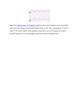 Note: The Cabrera's sign  (http://www.learntheheart.com/cardiology-review/cabreras-sign/)and Chapman’s sign  (http://www.lear