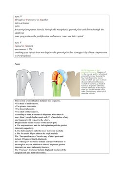 type IV
through or transverse or together
intra-articular
10%
fracture plane passes directly through the metaphysis, growth p