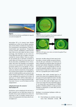 OCTUBRE  2014
  nº 496
SynergEyes PS: es la primera lente híbrida 
aprobada por la FDA con un diseño específico 
para córneas