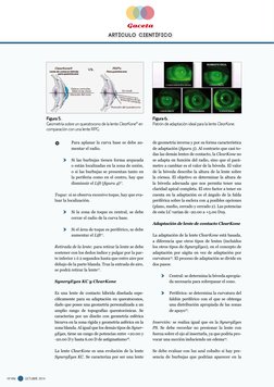 Gaceta
Artículo científico 
OCTUBRE  2014
  nº 496
Para aplanar la curva base se debe au-
mentar el radio.
c 
Si las burbuja
