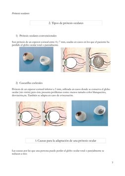 Prótesis oculares
2. Tipos de prótesis oculares
1) Prótesis oculares convencionales
Son prótesis de un espesor corneal entre