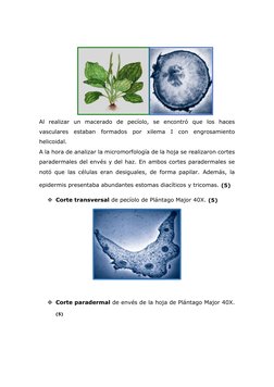 Al realizar un macerado de pecíolo, se encontró que los haces 
vasculares estaban formados por xilema I con engrosamiento