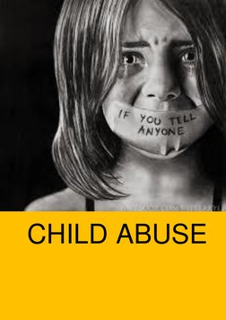 Page | 1  
 
 
CHILD ABUSE 
 
 
 
 
 
