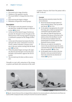 24
1
2
3
4
5
6
7
8
9
10
11
12
13
14
15
16
17
18
19
20
Chapter 3 · Techniques
Indications
Decreased active range of motion
 
5