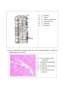 1) __b__ Miofibrilla. 
2) __f__ Túbulo T. 
3) __c__ Retículo sarcoplásmico. 
4) __e__ Cisterna terminal. 
5) __a__ Sarcol