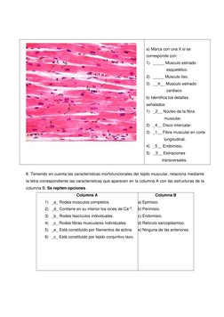 a) Marca con una X si se 
corresponde con: 
1) _____ Músculo estriado 
esquelético. 
2) _____ Músculo liso. 
3) __X__ Múscu