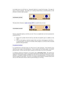 Ocular Motility: Cover Test Procedures | PDF | Neuropsychological ...