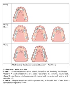Kennedy Classification of Partial Dentures | PDF | Face | Human Head ...
