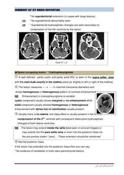 CT Brain Report Summary | PDF | Cerebrospinal Fluid | Nervous System