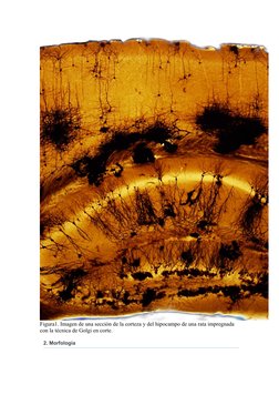 Figura1. Imagen de una sección de la corteza y del hipocampo de una rata impregnada 
con la técnica de Golgi en corte.
2. Mor
