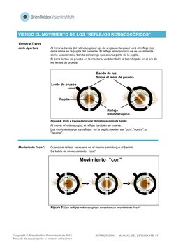 Copyright © Brien Holden Vision Institute 2012 
Paquete de capacitación en errores refractivos 
RETINOSCOPIA – MANUAL DEL E