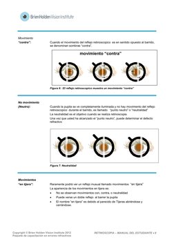 Copyright © Brien Holden Vision Institute 2012 
Paquete de capacitación en errores refractivos 
RETINOSCOPIA – MANUAL DEL E