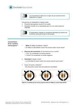 Copyright © Brien Holden Vision Institute 2012 
Paquete de capacitación en errores refractivos 
RETINOSCOPIA – MANUAL DEL E