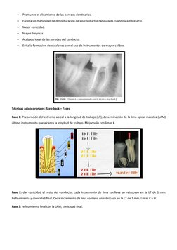 
Promueve el alisamiento de las paredes dentinarias.

Facilita las maniobras de desobturación de los conductos radiculares