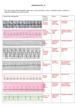 EXERCÍCIOS DE ECG - PS 
 
Para cada traçado eletrocardiográfico abaixo cite o nome da arritmia, o ritmo, 2 possíveis causas e