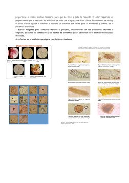 proporciona el medio alcalino necesario para que se lleve a cabo la reacción. El calor requerido es
proporcionado por la reac