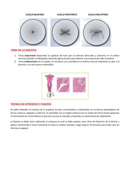 CUELLO NULIPARO                         CUELLO POSTPARTO                     CUELLO MULTIPARO