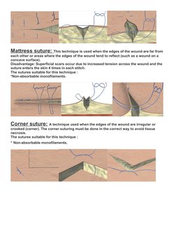 Subcutaneous Suturing Techniques Guide | PDF | Surgical Suture ...