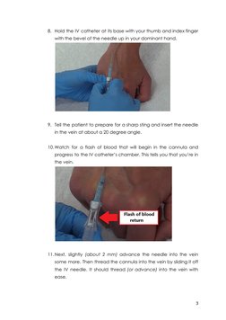 Step-by-Step IV Insertion Guide | PDF | Intravenous Therapy | Syringe