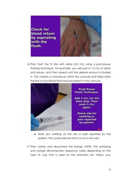 Step-by-Step IV Insertion Guide | PDF | Intravenous Therapy | Syringe