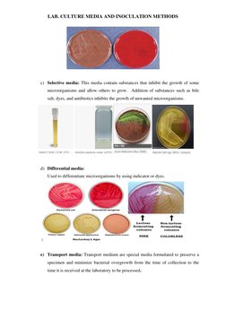 LAB. CULTURE MEDIA AND INOCULATION METHODS 
 
 
c) Selective media: This media contain substances that inhibit the growth of
