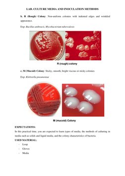LAB. CULTURE MEDIA AND INOCULATION METHODS 
M (mucoid) Colony 
b. R (Rough) Colony: Non-uniform colonies with indented edges
