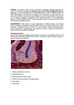 CLÍNICA: En algunos casos pueden presentarse náuseas, vómitos, anorexia. Es 
común la presencia de dolor en epigastrio tipo u