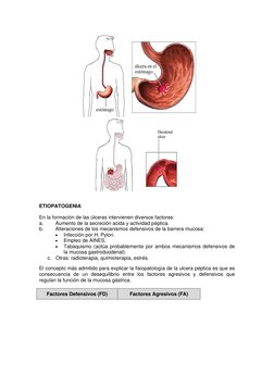ETIOPATOGENIA 
En la formación de las úlceras intervienen diversos factores: 
a. 
Aumento de la secreción acida y activid