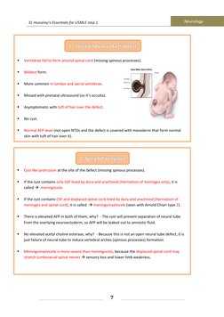 EL Husseiny's Essentials for USMLE step 1 
            Neurology 
 
 
 
7
