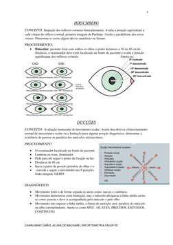 7 
 
CHARLIANNY GIRÃO, ALUNA DO BACHAREL EM OPTOMETRIA FASUP-PE 
 
HIRSCHBERG 
CONCEITO: Inspeção dos reflexos corneais binoc