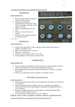 9 
 
CHARLIANNY GIRÃO, ALUNA DO BACHAREL EM OPTOMETRIA FASUP-PE 
 
AVALIAÇÃO DINAMICA DO SISTEMA PUPILO MOTOR:       
FOTOMOT