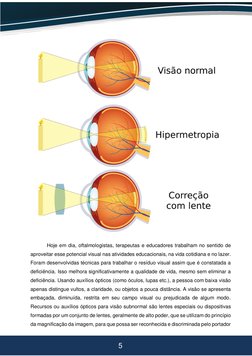 5 
 
 
 
 Hoje em dia, oftalmologistas, terapeutas e educadores trabalham no sentido de 
aproveitar esse potencial visual nas