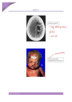 High-Yield NBME Images Guide | PDF | Diseases And Disorders | Medical ...