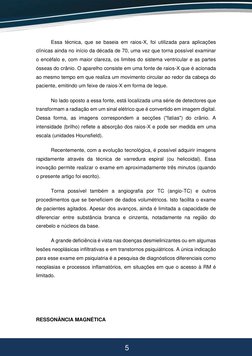 5 
5 
Essa técnica, que se baseia em raios-X, foi utilizada para aplicações 
clínicas ainda no início da década de 70,