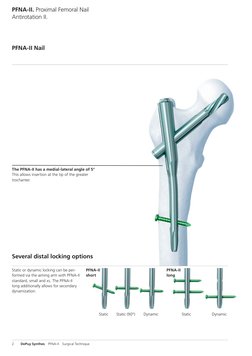 PFNA-II Surgical Technique Guide | PDF | Drill | Electrical Connector