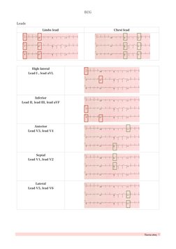 ECG
Leads 
 
Limbs lead
Chest lead
High lateral  
Lead I , lead aVL
Inferior  
Lead II, lead III, lead aVF
Anterior  
Lead V3