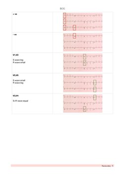 ECG
 
+ ve
- ve
V1,V2 
S wave big 
R wave small 
V5,V6 
S wave small 
R wave big
V3,V4 
S+R wave equal
Nawraa ateeq   3
