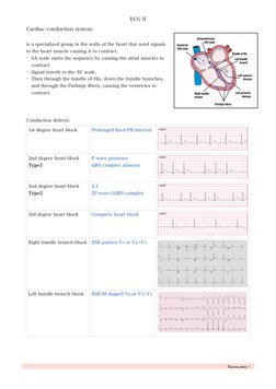 ECG II
Cardiac conduction system: 
is a specialized group in the walls of the heart that send signals 
to the heart muscle ca