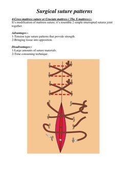Overview of Surgical Suture Patterns | PDF | Surgical Suture | Wound