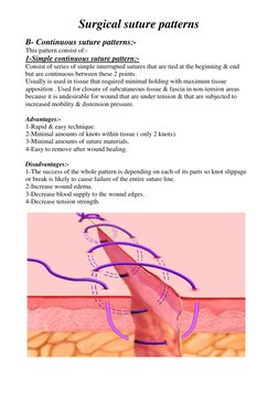 Overview of Surgical Suture Patterns | PDF | Surgical Suture | Wound