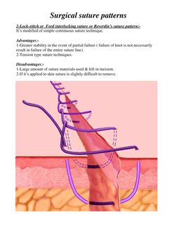 Overview of Surgical Suture Patterns | PDF | Surgical Suture | Wound