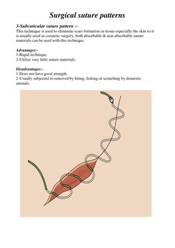 Overview of Surgical Suture Patterns | PDF | Surgical Suture | Wound