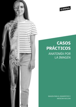 CASOS 
PRÁCTICOS
IMAGEN PARA EL DIAGNÓSTICO Y 
MEDICINA NUCLEAR
ANATOMÍA POR 
 LA IMAGEN
