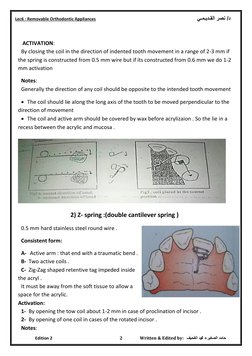 Overview of Orthodontic Springs | PDF | Orthodontics | Dental Anatomy