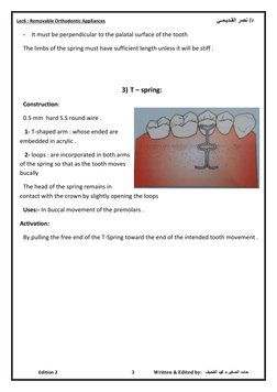 Overview of Orthodontic Springs | PDF | Orthodontics | Dental Anatomy