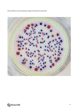 Counting Bacterial Colonies on Agar Plates | PDF | Colony Forming Unit